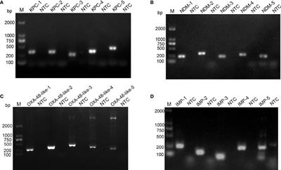 Rapid Detection of blaKPC, blaNDM, blaOXA-48-like and blaIMP Carbapenemases in Enterobacterales Using Recombinase Polymerase Amplification Combined With Lateral Flow Strip